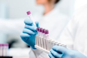 Secretaria Municipal de Saúde realiza coletiva para esclarecer suspensão de exames laboratoriais