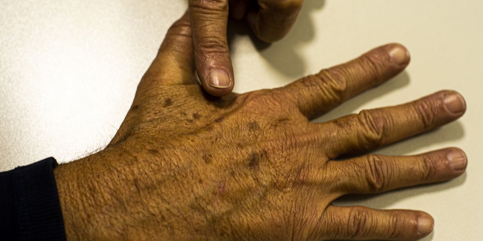 sus-pode-gastar-r$-7,84-bi-em-2040-com-tratamento-de-cancer,-diz-inca