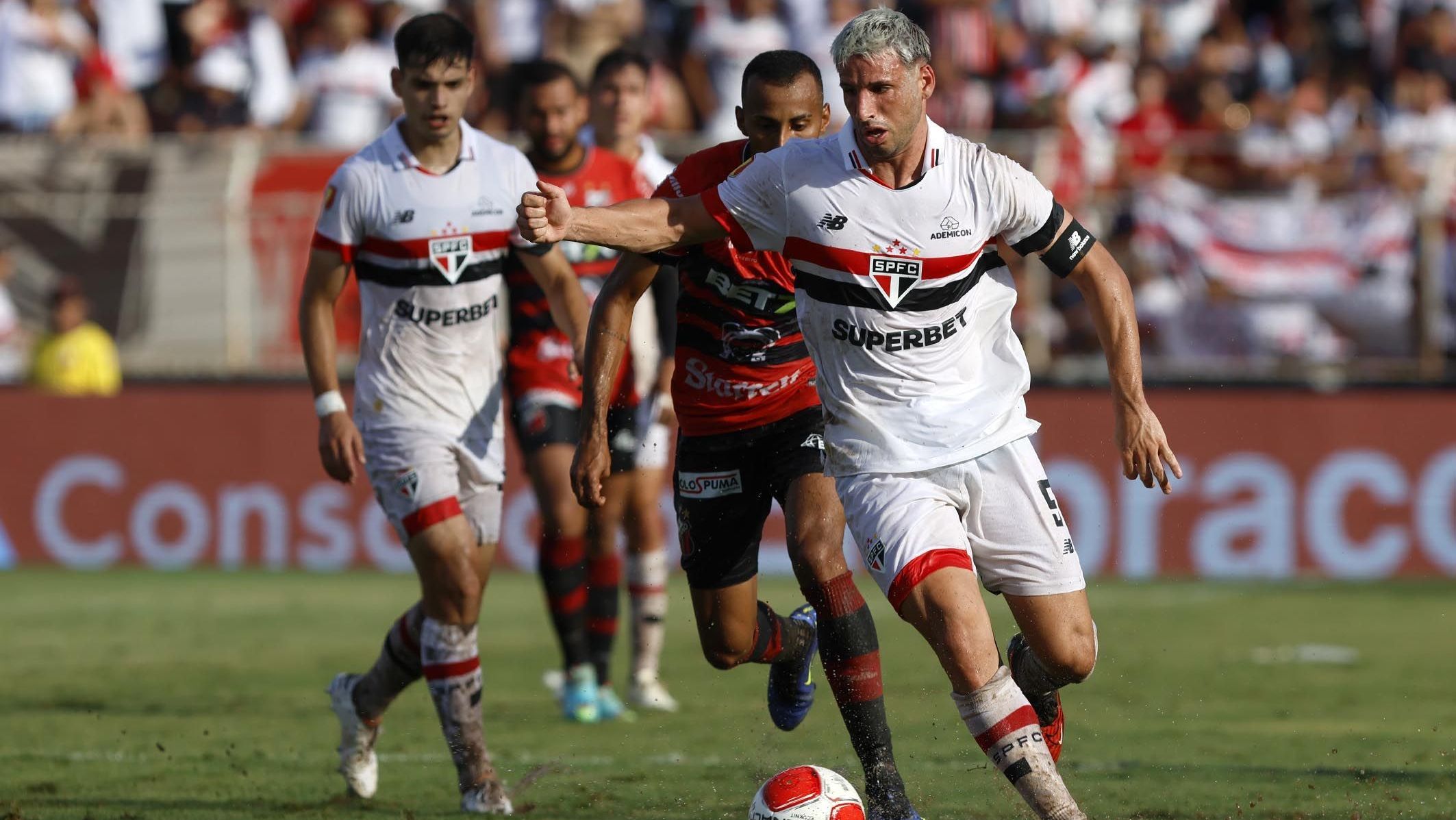 calleri-tem-rompimento-de-cisto-e-pode-desfalcar-sao-paulo-no-paulistao