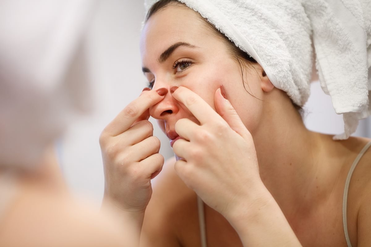 pascoa:-chocolate-causa-espinhas?-dermatologista-explica