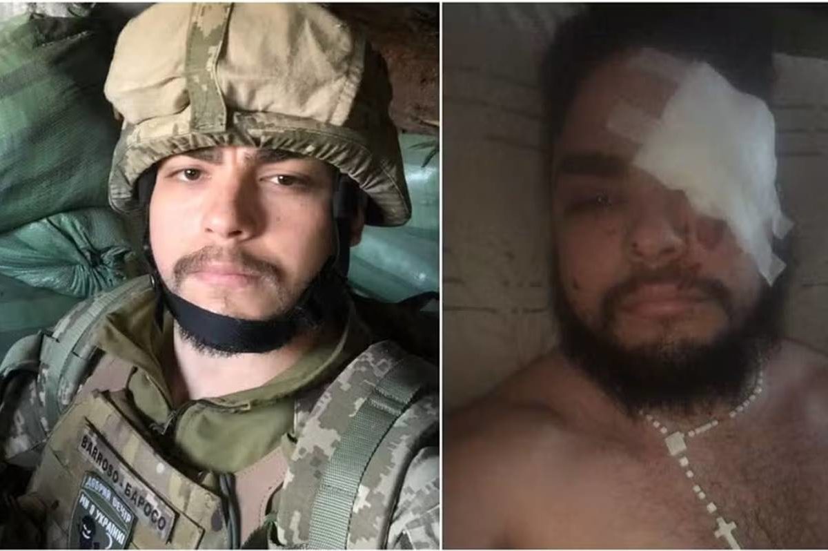 “quebrado”,-diz-brasileiro-que-se-feriu-ao-pisar-em-mina,-na-ucrania